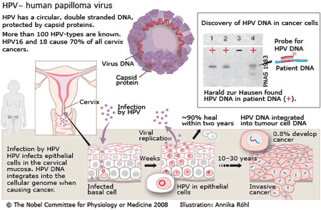 HPV causes Cervical Cancer